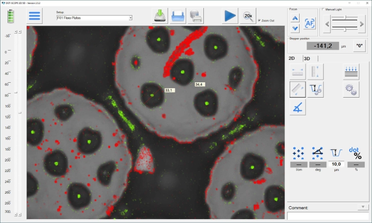 analyse of micro cells of flexo plates